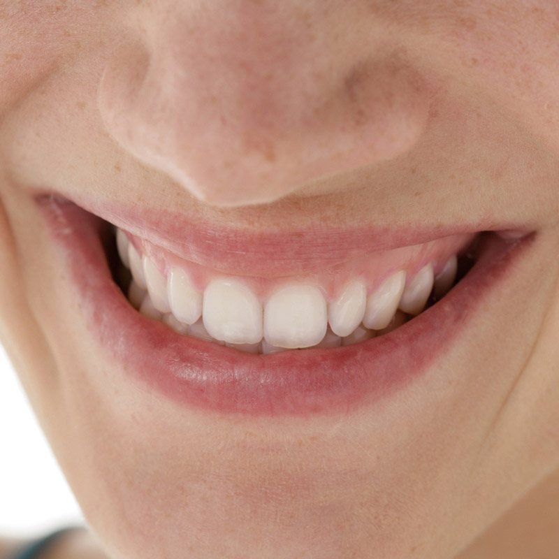 Ein lächelnder Mund mit schönen und gesunden 
							Zähnen